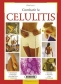 Libro: Combatir la celulitis | Autor: Elisa Lecci | Isbn: 9788430561605
